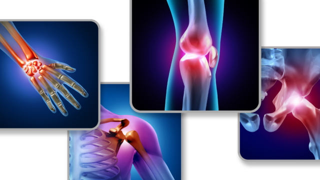 General Orthopedics