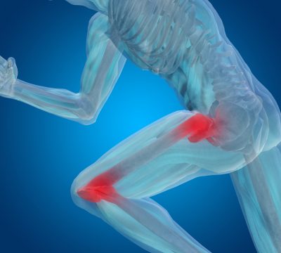 The Active Person’s Guide to Hip and Knee Osteoarthritis Prevention