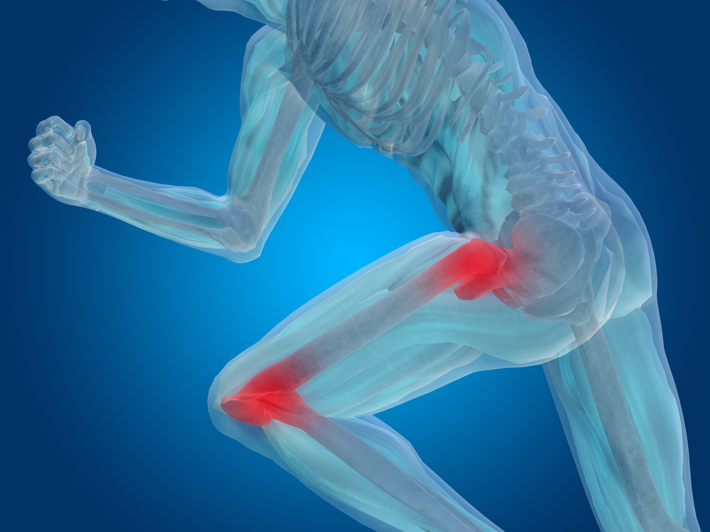 The Active Person’s Guide to Hip and Knee Osteoarthritis Prevention