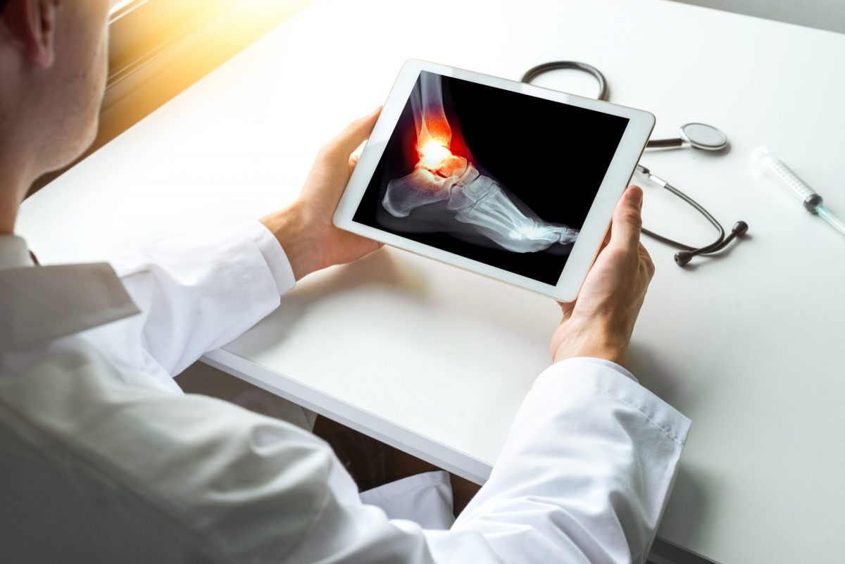 Doctor watching x-ray of sprained or broken ankle with pain on a digital tablet. Stethoscope and syringe on the desk