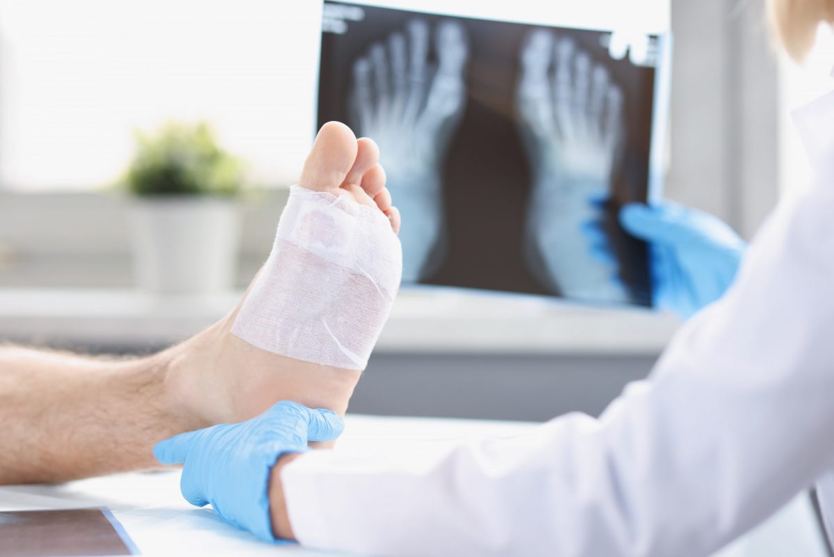 How Long Does a Sprained Ankle Take to Heal and Other Questions