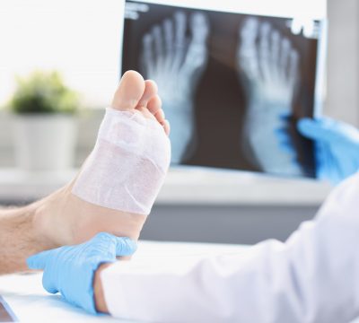 How Long Does a Sprained Ankle Take to Heal and Other Questions