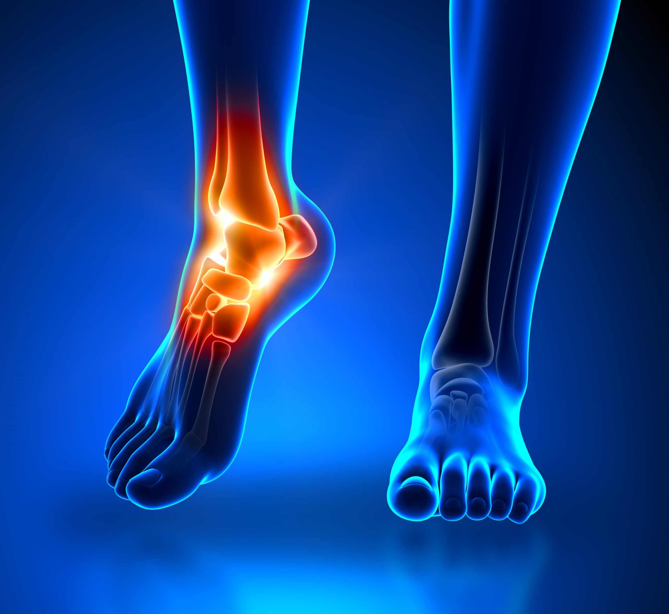 A 3D image portrays a sprained ankle, highlighted in orange.
