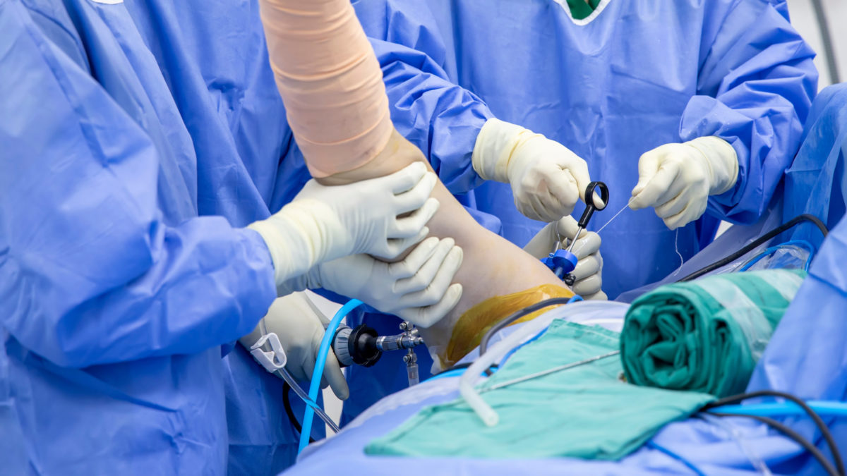 Surgeons perform an arthroscopic procedure on a patient’s shoulder. 