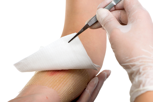 An orthopedic urgent care doctor removes a dressing with tweezers from a patient’s forearm wound. 