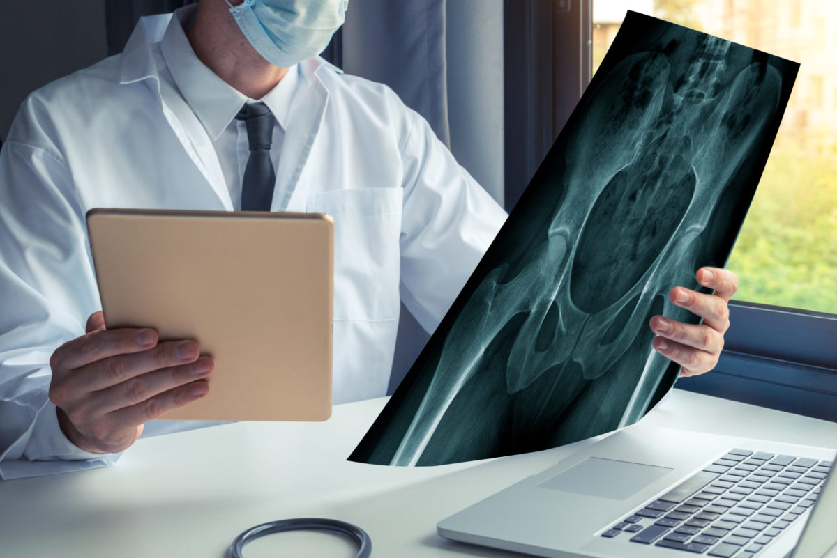  A male surgeon in a face mask compares an X-ray of a patient’s hip on film, his tablet, and laptop.