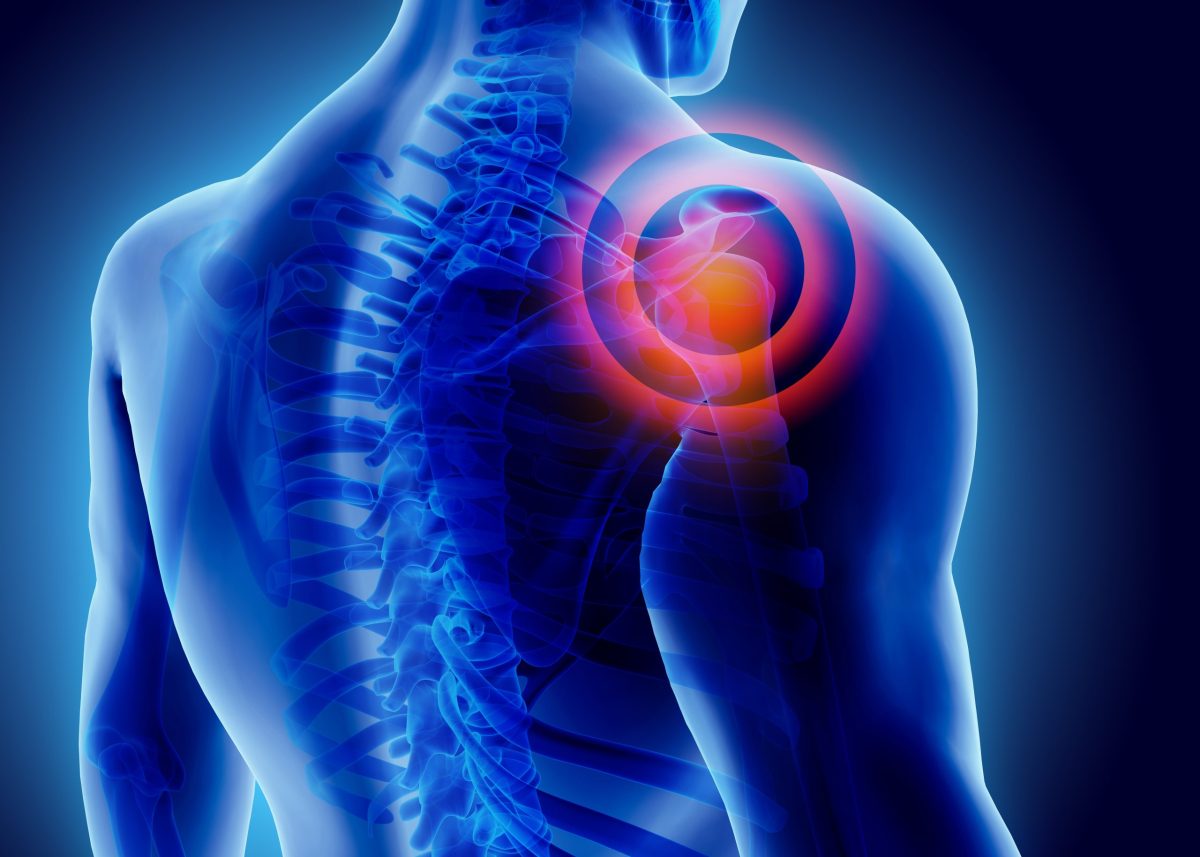 3D illustration of shoulder pain using a red target on blue background.