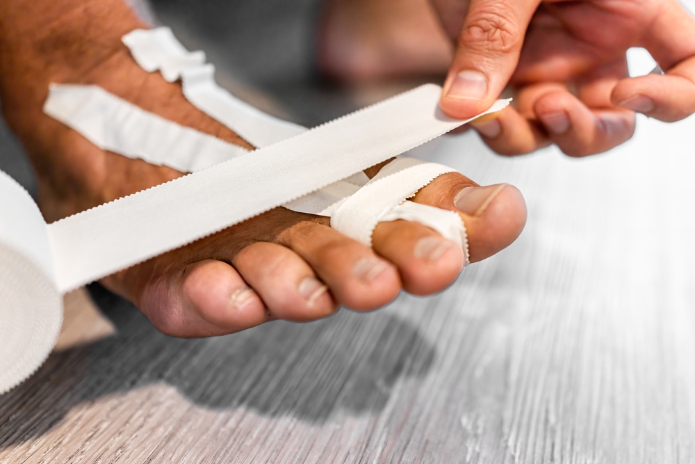 A patient tapes her second toe for capsulitis treatment.
