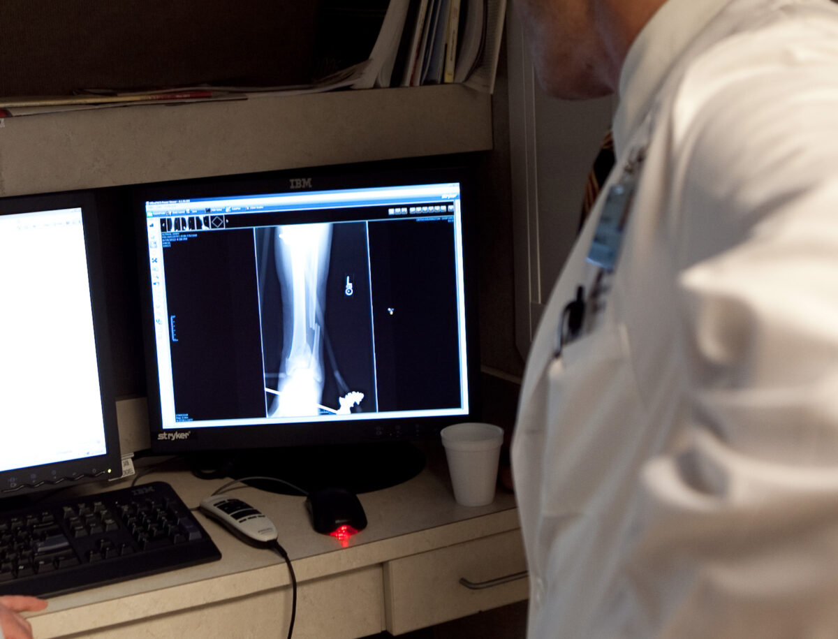doctor examining x-ray scan of ankle