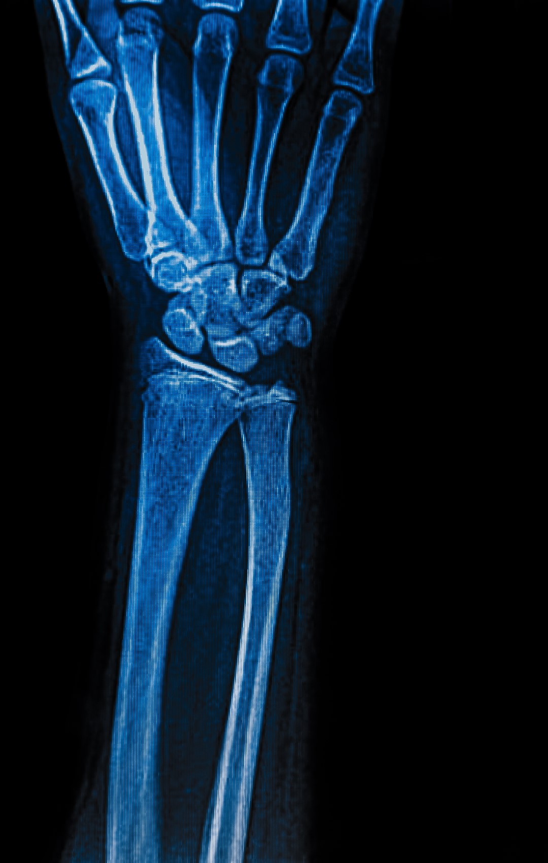 An X-ray image of a wrist is highlighted in blue.